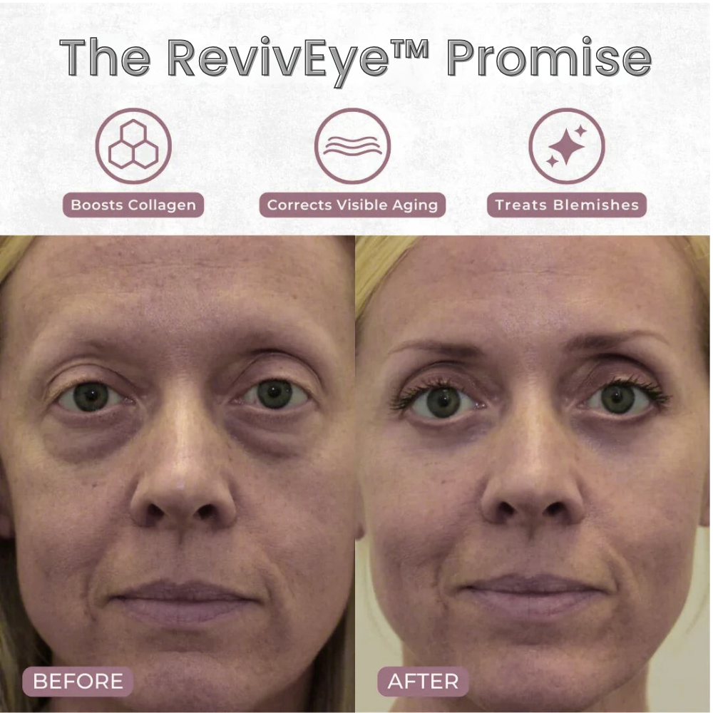 RevivEye - Eye Rejuvenator