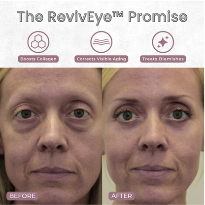 RevivEye - Eye Rejuvenator